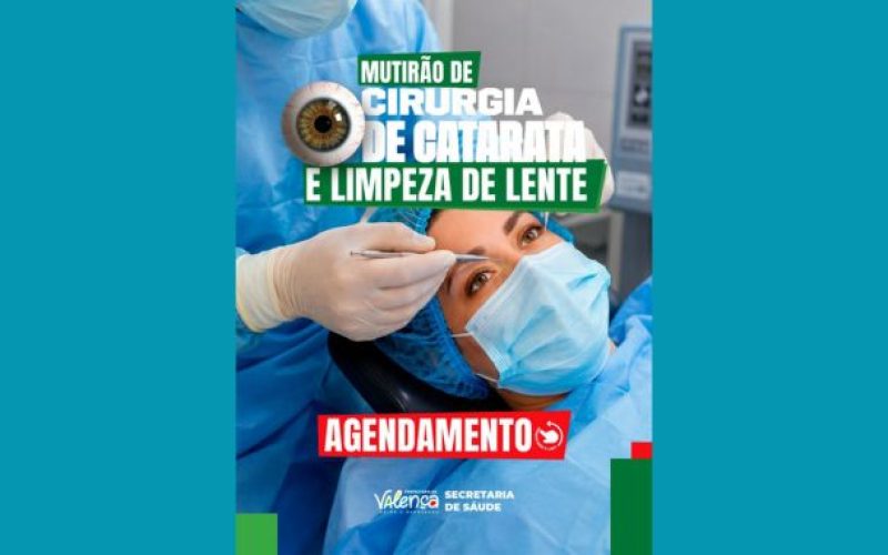 Agendamento para Mutirão de Cirurgia de Catarata e Limpeza de Lente começa dia 25 em Valença
